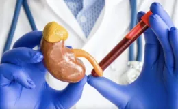Kreatinin Nedir? Yüksekliği ve Düşüklüğü: Neden Ölçülür ve Sebepleri Nelerdir?
