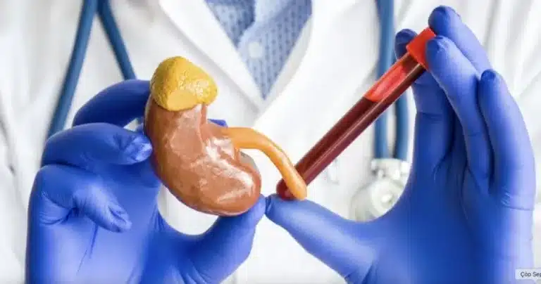 Kreatinin Nedir? Yüksekliği ve Düşüklüğü: Neden Ölçülür ve Sebepleri Nelerdir?