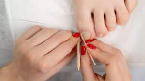 Batık tırnak sorununu önlemek için etkili yöntemler ve ipuçları. Sağlıklı