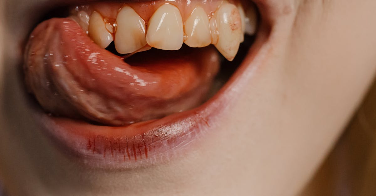 tongue-discoloration-117.jpeg