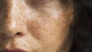 Unlock timeless beauty secrets with ancient wisdom for modern skin