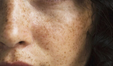 Ancient Wisdom for Modern Skin Care