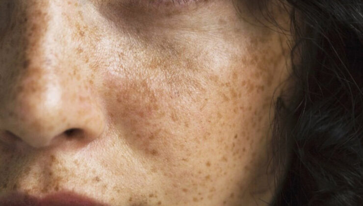 Ancient Wisdom for Modern Skin Care
