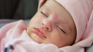 Doğum lekelerinin oluşma nedenlerini, türlerini ve olası tedavi yöntemlerini keşfedin.