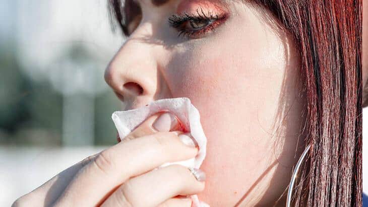 Sivilceye Yol Açan Günlük Cilt Bakım Hataları ve Alışkanlıklar