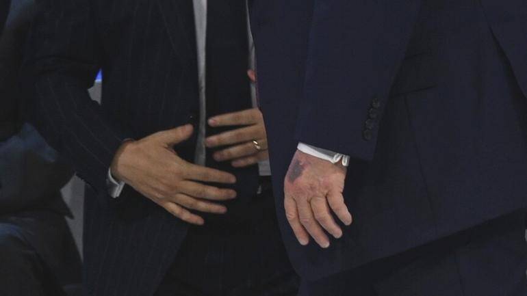 Trump’ın sağlık durumu “mükemmel” olarak açıklandı