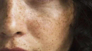 Ancient Wisdom for Modern Skin Care
