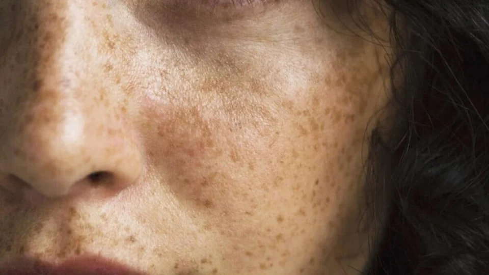 Ancient Wisdom for Modern Skin Care